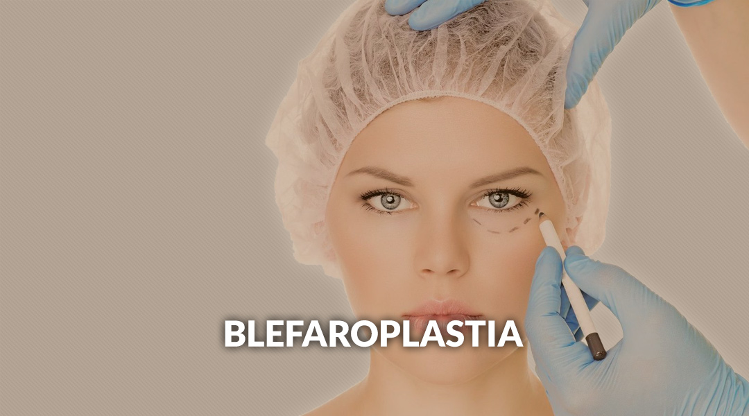 Blefaroplastia