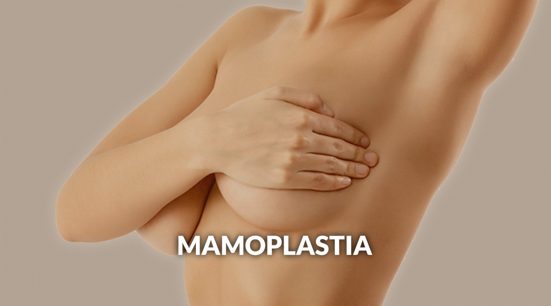 Mamoplastia