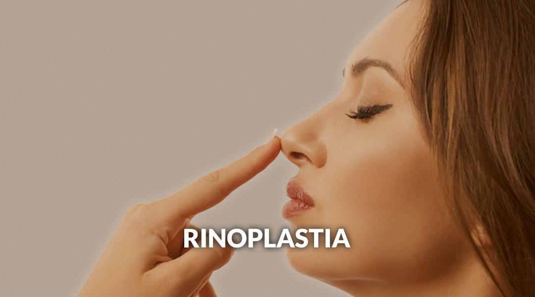 Rinoplastia